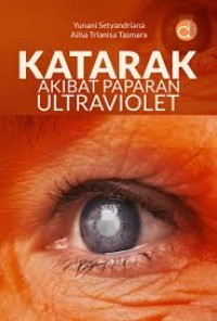 Image of Katarak akibat paparan ultraviolet