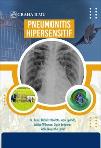 Image of Pneumonitis hipersensitif