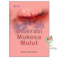 Ulserasi Mukosa Mulut